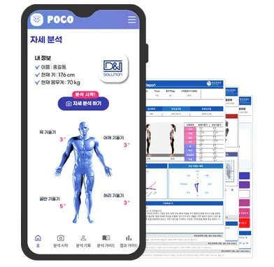 AI 자세분석 결과를 모바일 화면으로 시각화한 분석 리포트 예시