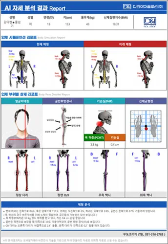 관절 각도와 체형 지표를 포함한 AI 자세분석 상세 리포트 화면