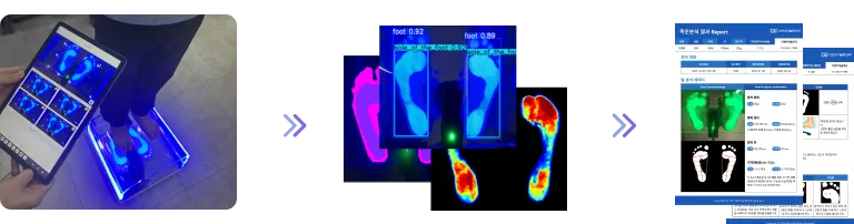 AI 알고리즘을 활용해 족문 데이터를 자동 분석하는 시스템 처리 과정 이미지